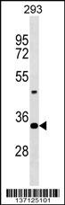 Mouse Hoxd9 Antibody