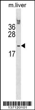 Hoxb6 Antibody
