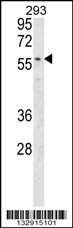 MBOAT2 Antibody