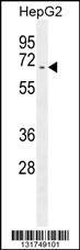 UAP1 Antibody