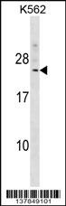DCAKD Antibody