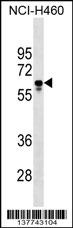 PGS1 Antibody