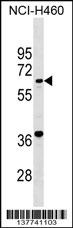 GATB Antibody