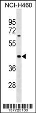 MYBPH Antibody