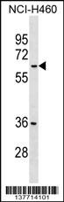 MDH1B Antibody
