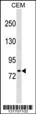 LONRF3 Antibody