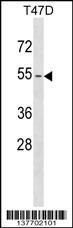 KRT79 Antibody