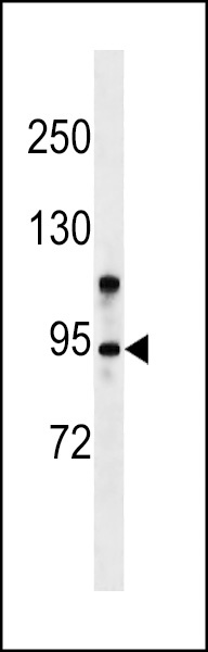 ZMYM6 Antibody
