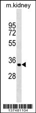 ZFP36L2 Antibody