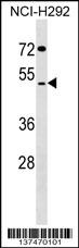 SUDS3 Antibody