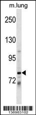 DACH1 Antibody