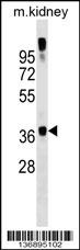GTF2A1 Antibody