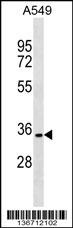 PACRG Antibody