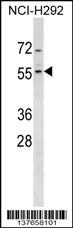 ZNF200 Antibody