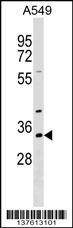 RBM11 Antibody