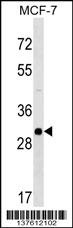 RAB26 Antibody