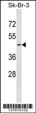 QTRT1 Antibody