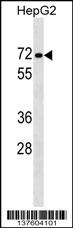 PPP1R16B Antibody