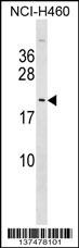 MPLKIP Antibody
