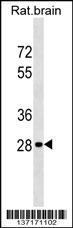 Hoxd9 Antibody