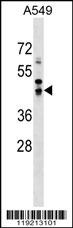 SAV1 Antibody