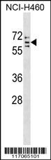 CYP4V2 Antibody