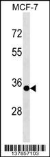 EPSTI1 Antibody