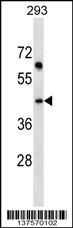 SDF4 Antibody