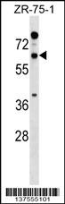 RTN2 Antibody