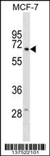 GGT6 Antibody