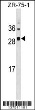 SPC25 Antibody