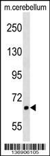 AKAP8L Antibody