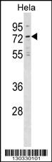 NET1 Antibody