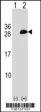 UBE2T Antibody