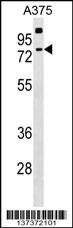 TKTL2 Antibody