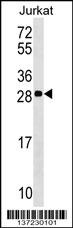 ANP32C Antibody