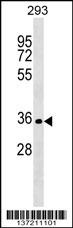 SIX2 Antibody