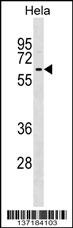 KLHL12 Antibody