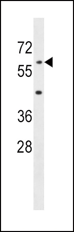 AOAH Antibody