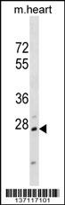 Hoxb1 Antibody