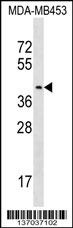 PSG9 Antibody