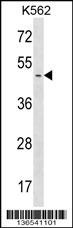 PPME1 Antibody