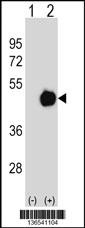 PPME1 Antibody