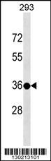 TSPY3 Antibody