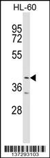 ABTB1 Antibody