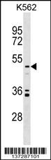 UST Antibody
