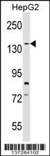 SYCP1 Antibody