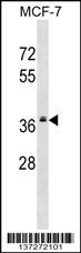MRPL2 Antibody
