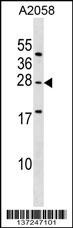 EPDR1 Antibody