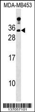 LIN7A Antibody